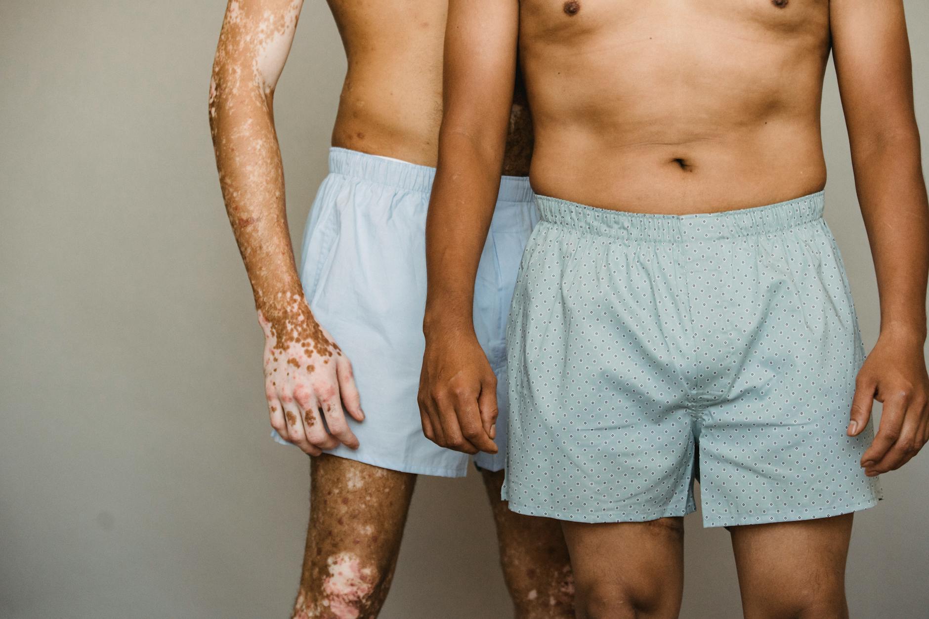 Bőrbetegségek: Pikkelysömör, Ekcéma és Dermatitisz Tünetei